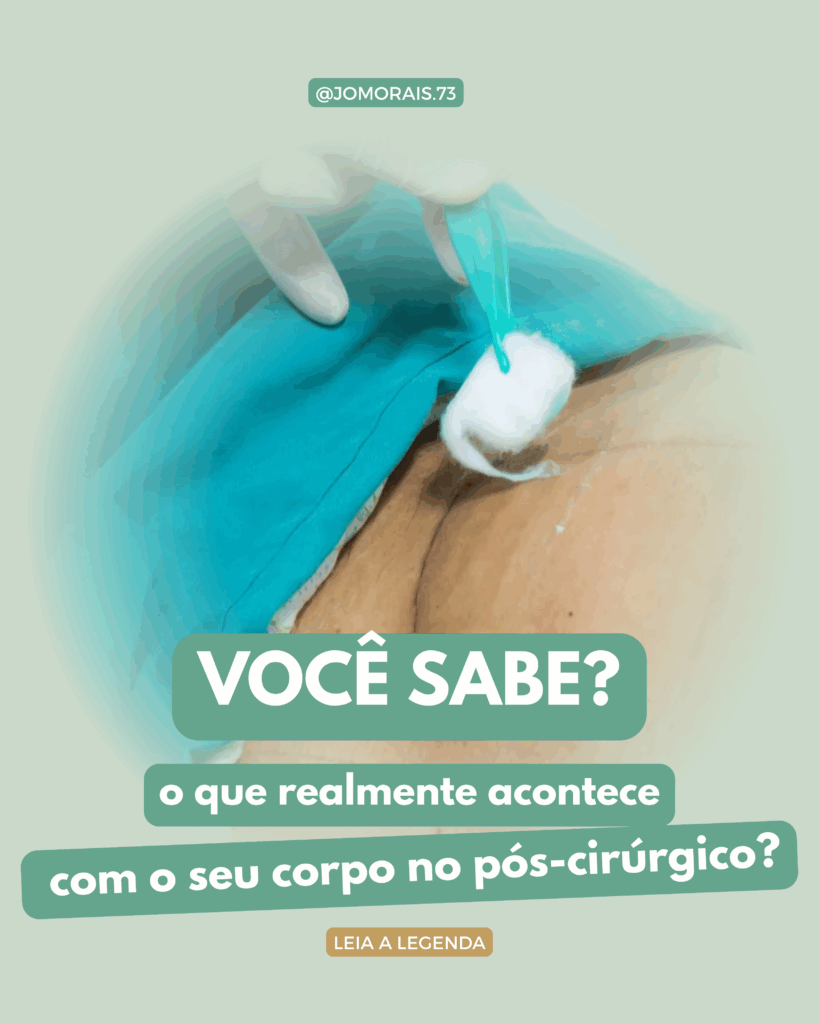 POS-CIRURGICO-819x1024 Você sabe o que realmente acontece com o seu corpo no pós-operatório?