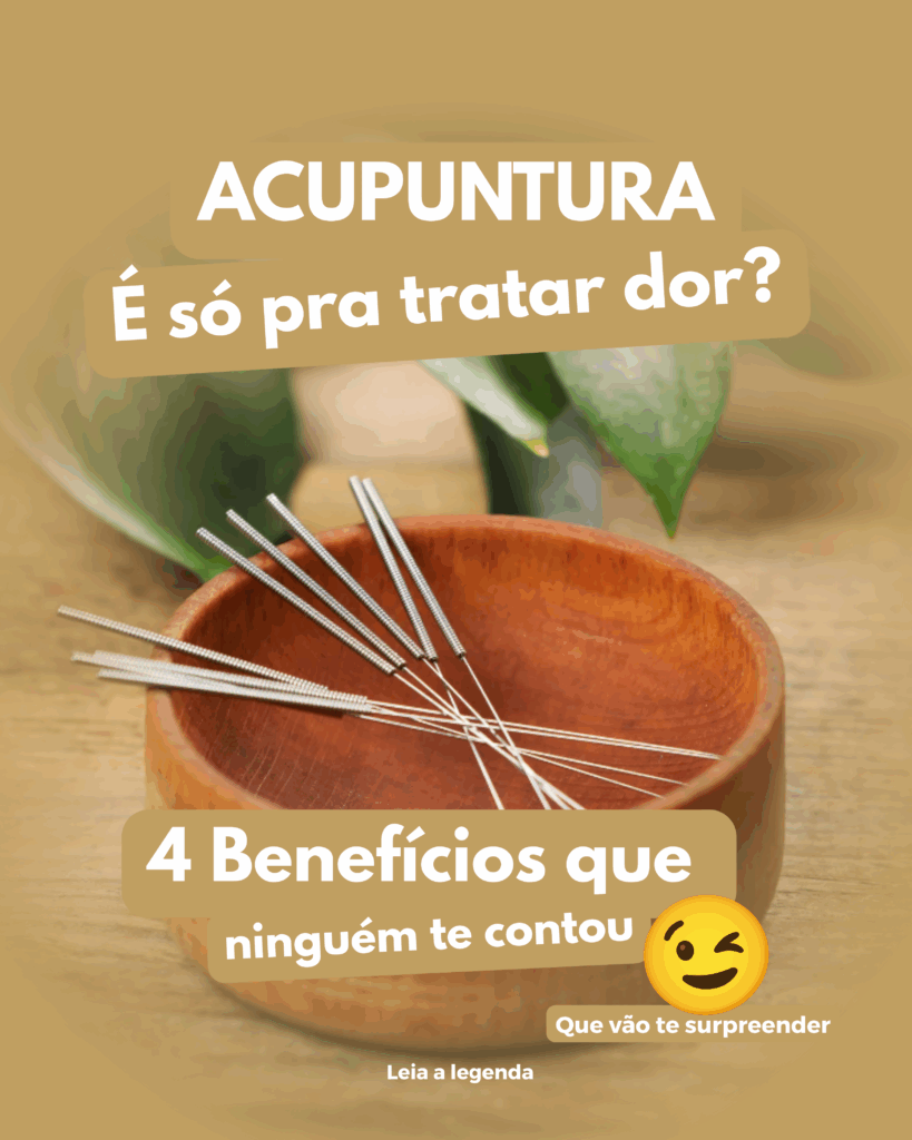 acupuntura-819x1024 Quanto tempo dura o efeito da acupuntura?