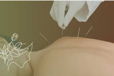 Acupuntura, Drenagem Linfática e Esculpe Detox no Tucuruvi