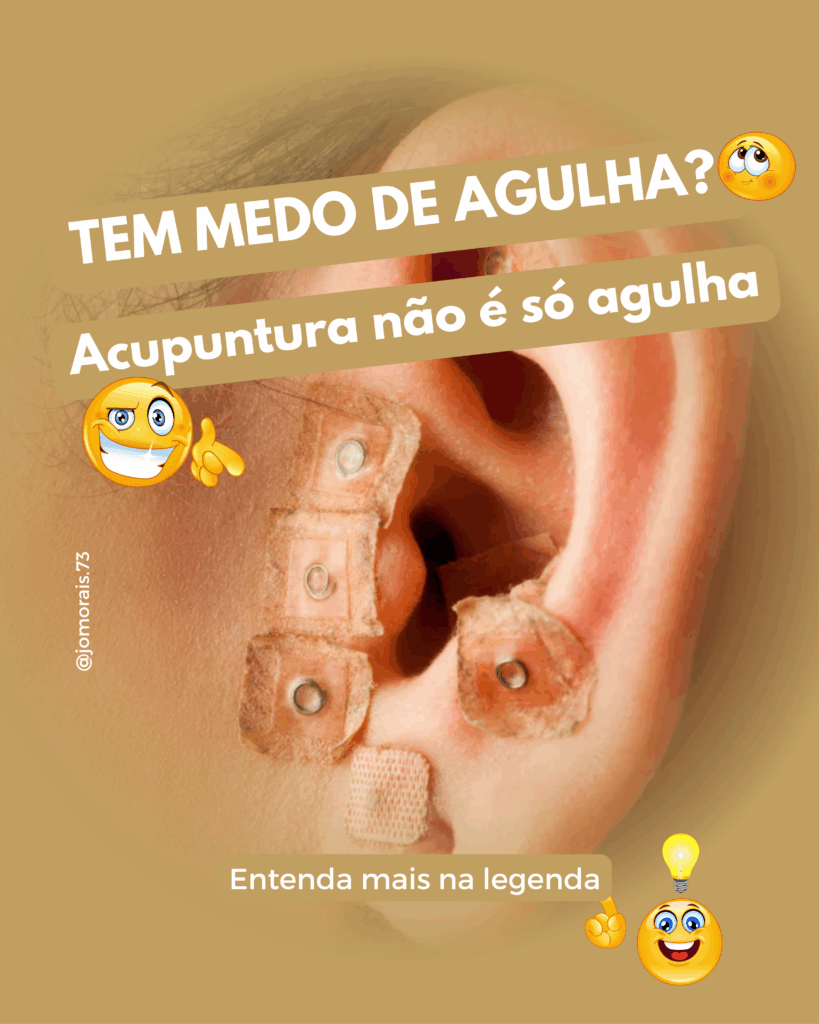 Auriculoterapia-sementes-819x1024 Acupuntura não é só agulha