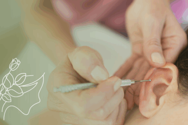 Quanto tempo dura o efeito da acupuntura?