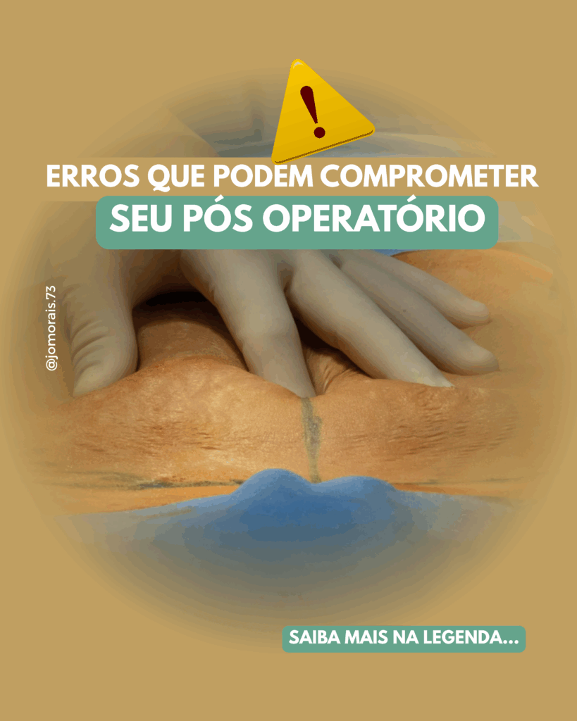 ERROS-NO-POS-OPERATORIO-819x1024 Erros que podem comprometer seu pós-operatório