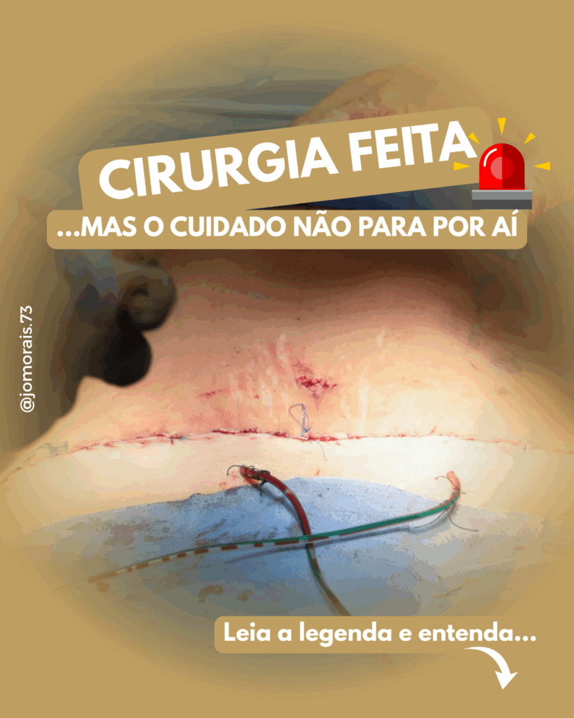 POS-OPERATORIO-819x1024 Por que Fazer Drenagem Linfática no Pós-Operatório?