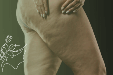 É normal a barriga inchar depois da drenagem linfática?