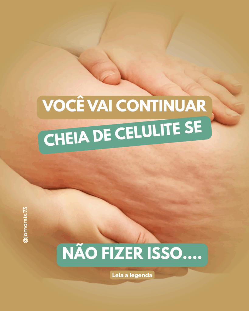 CELULITE-819x1024 Método Esculpe Detox ajuda a combater a celulite de dentro para fora