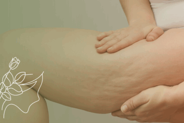 O que acontece com o corpo após a drenagem linfática?