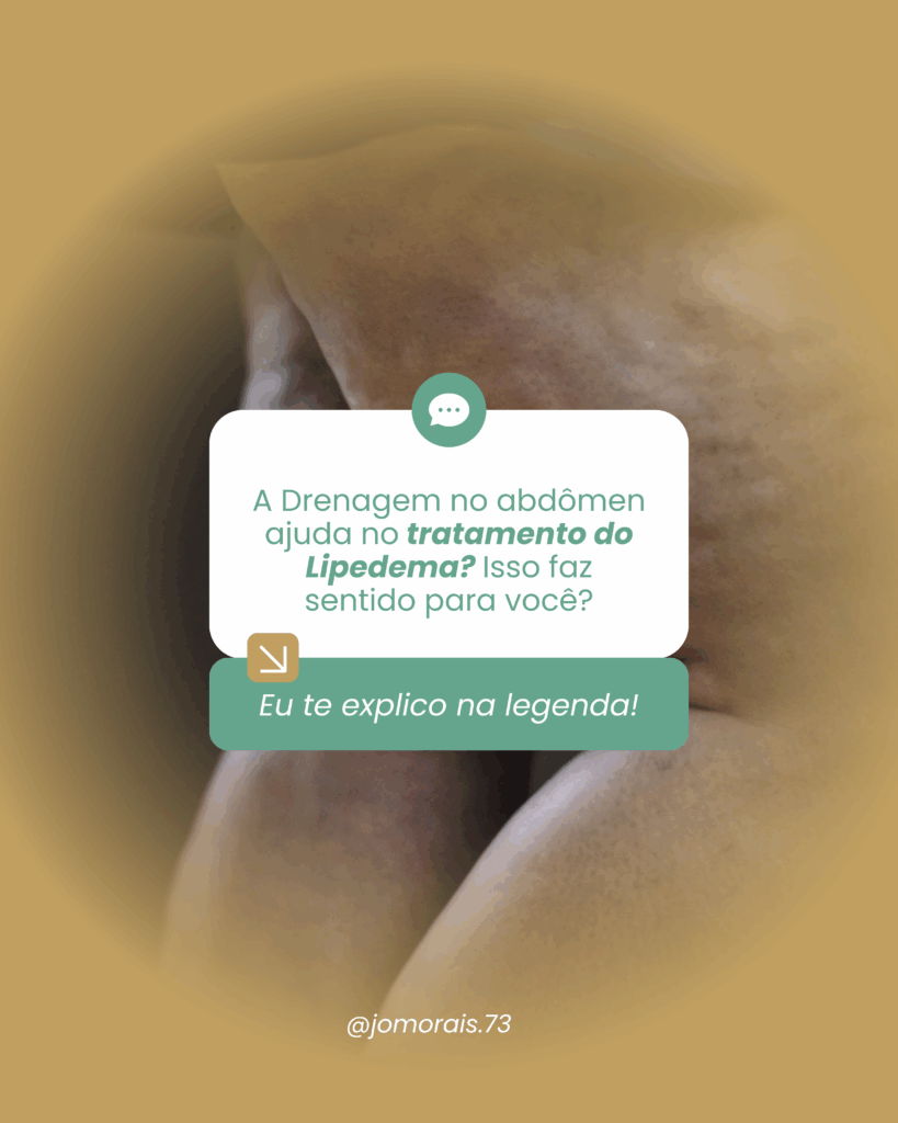 A-Drenagem-no-abdomen-ajuda-no-tratamento-do-Lipedema-Isso-faz-sentido-para-voce-1-819x1024 Drenagem no abdômen: o segredo para tratar o Lipedema de forma eficaz
