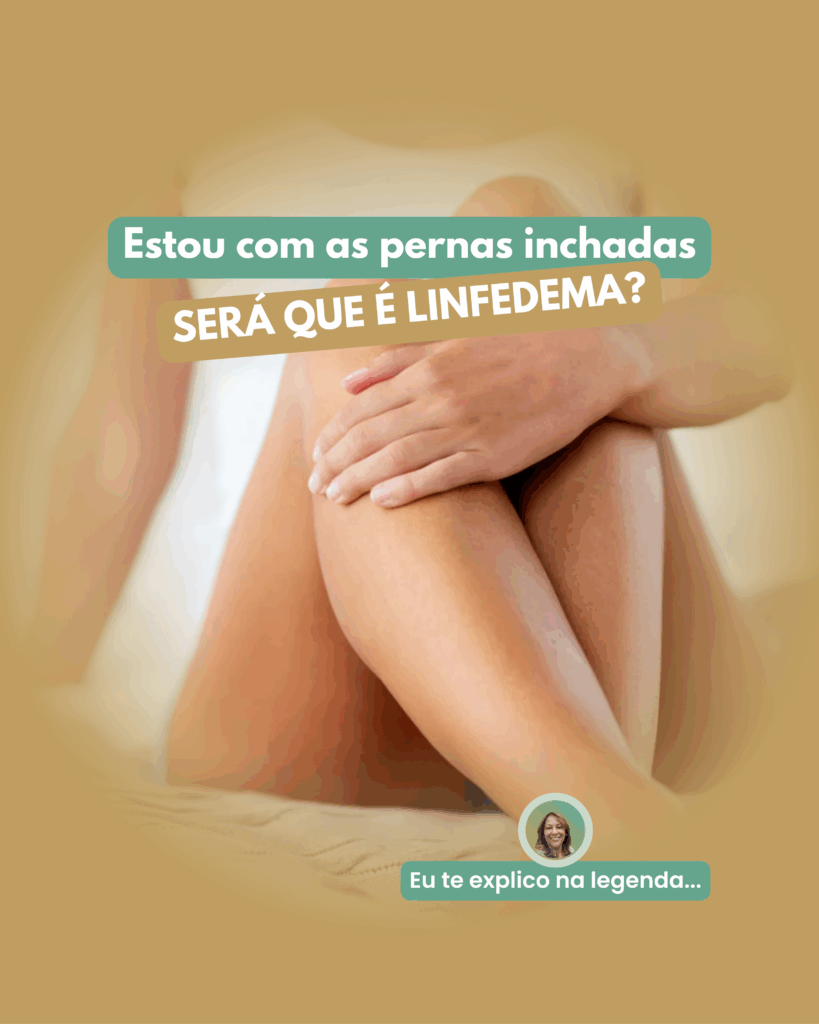 Estou-com-as-pernas-inchadas-819x1024 Como Saber se Você Tem Linfedema?