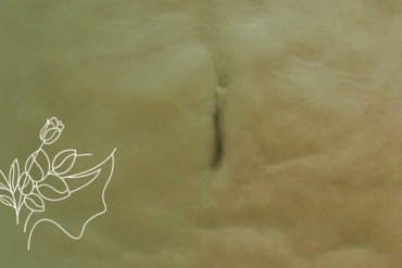 Cuidados Essenciais Antes da Drenagem Linfática