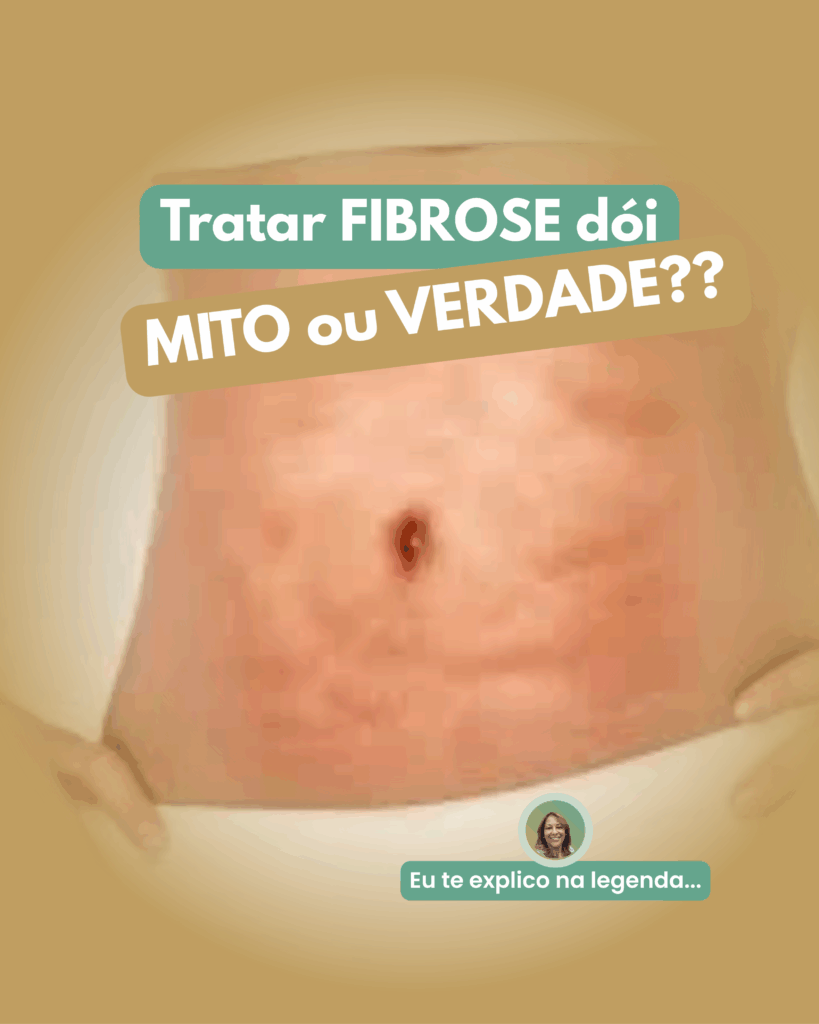Tratar-FIBROSE-doi-819x1024 Tratar fibrose dói?