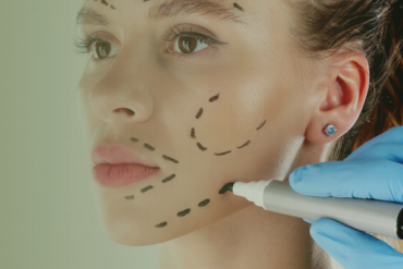 Pode fazer drenagem no rosto depois do Botox?
