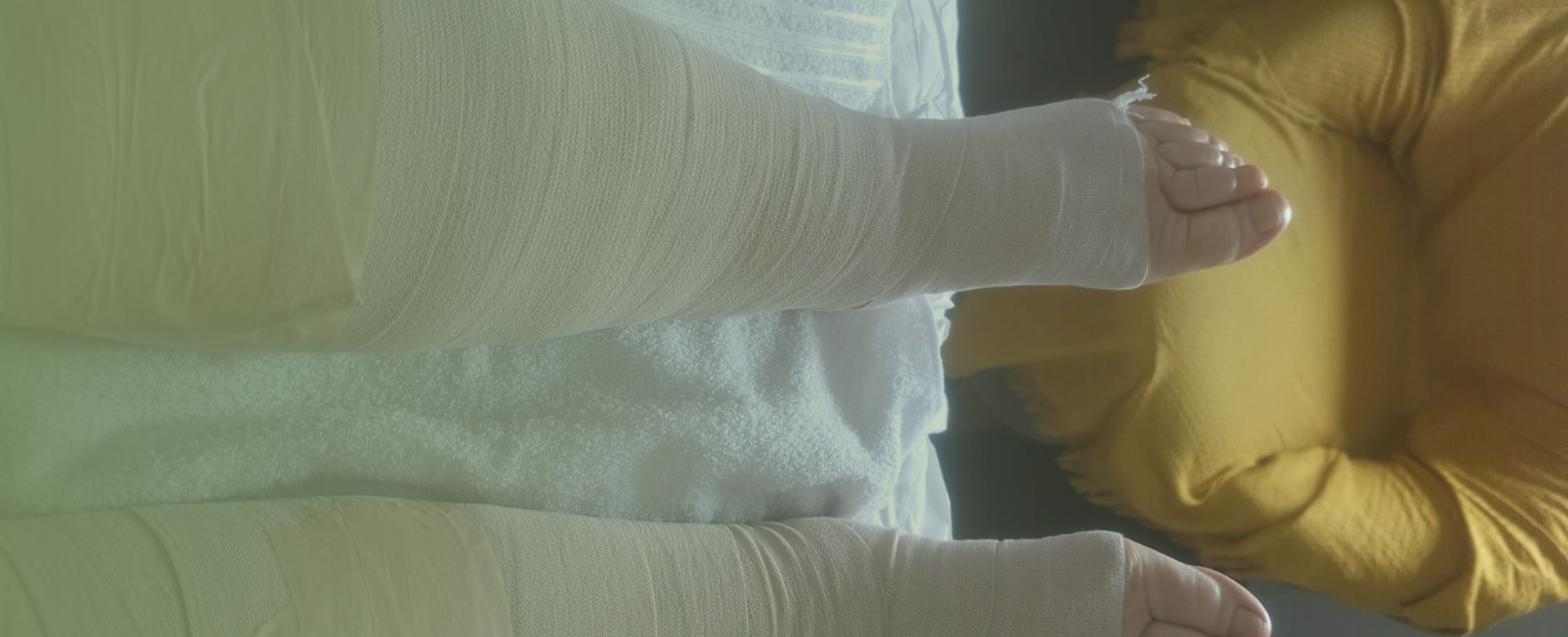linfedema Enfaixamento compressivo no tratamento do linfedema