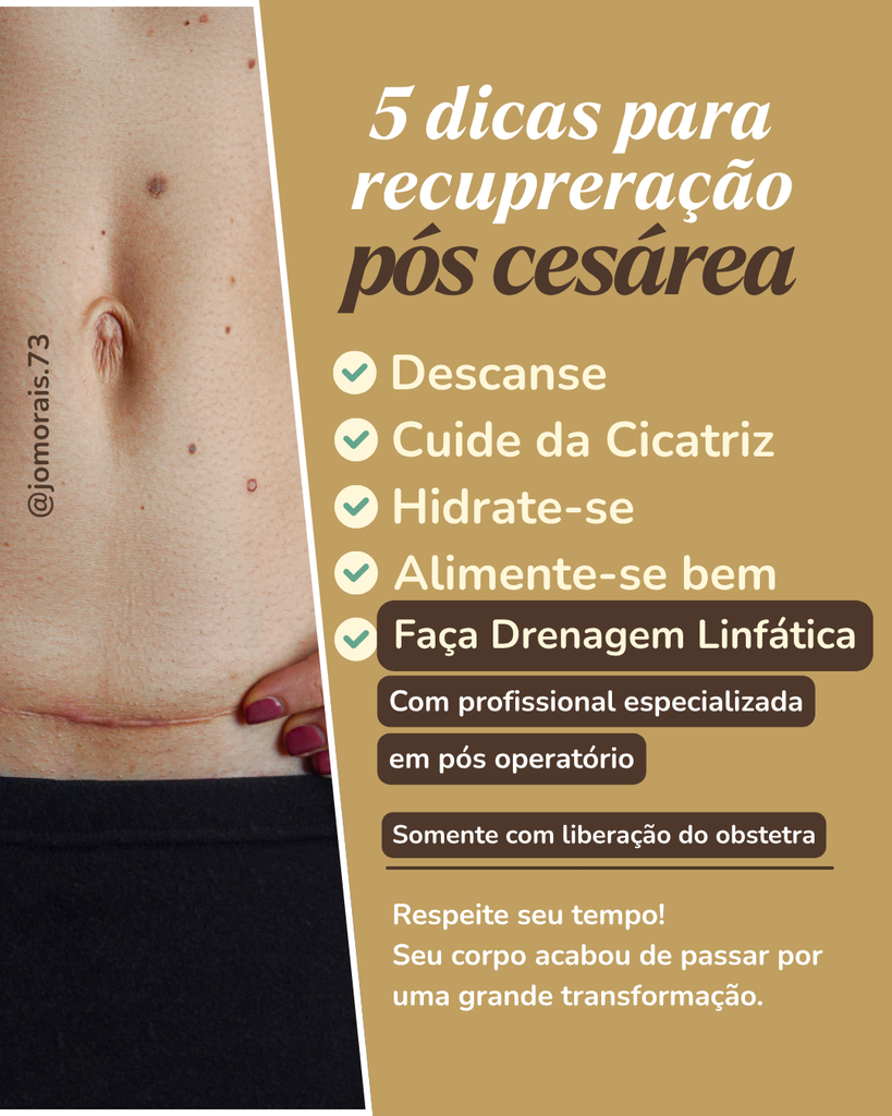 Drenagem-pos-cesarea-3-819x1024 5 dicas para uma boa recuperação após o parto cesárea